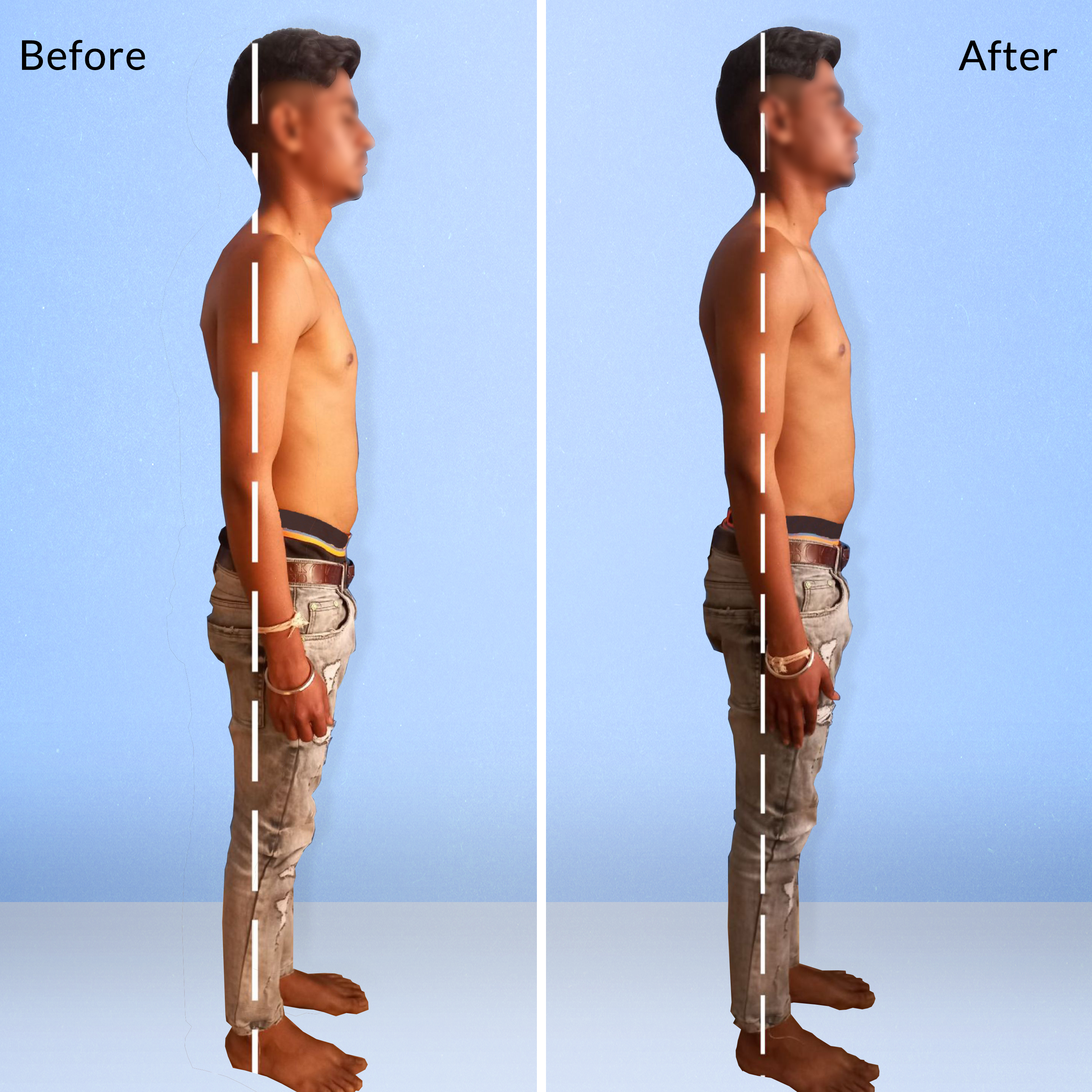 Orthopaedic Rehabilitation